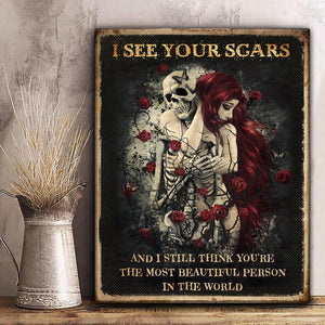 Poster - Canvas I See Your Scars Skull Couple For Wife, For Husband, Anniversary Personalized Canvas, Poster Custom Design Wall Art - Love Mine Gifts